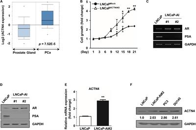 α-Actinin-4 Promotes the Progression of Prostate Cancer Through the Akt/GSK-3β/β-Catenin Signaling Pathway